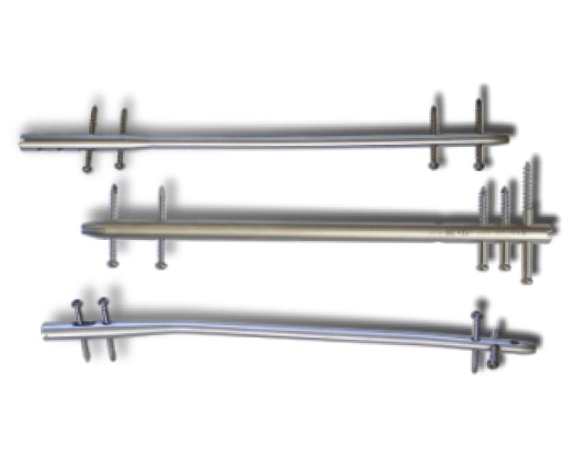 Trauma_Interlocking Nail Systems Retrograde Femoral Interlocking Nail