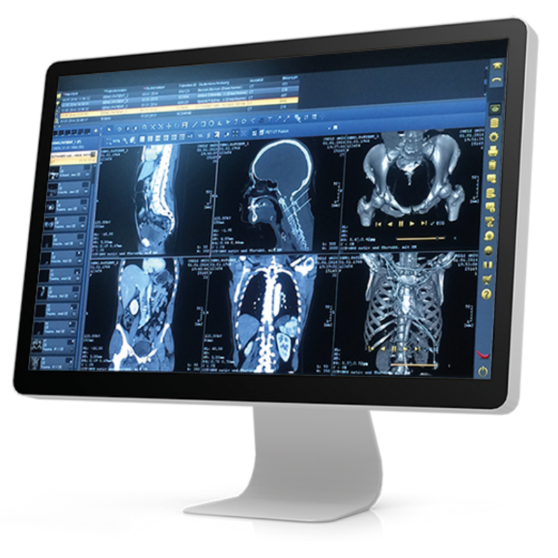 PACS Radiology System