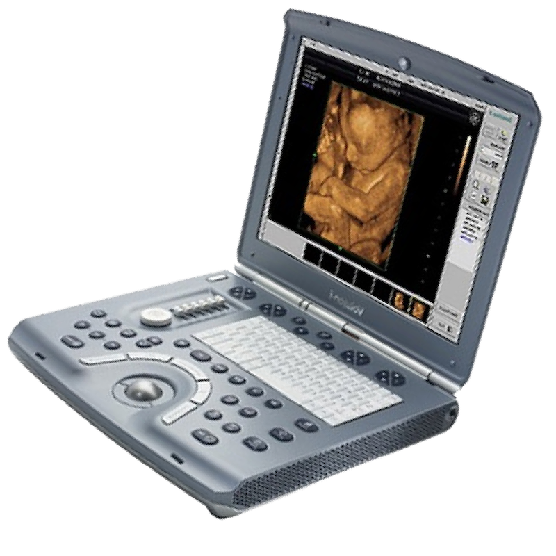 Portable Gynecology Ultrasound Machine